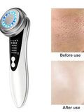 5-In-1 Facial Massager: LED Light Therapy, Eye Care, Skin Smoothing, USB Rechargeable