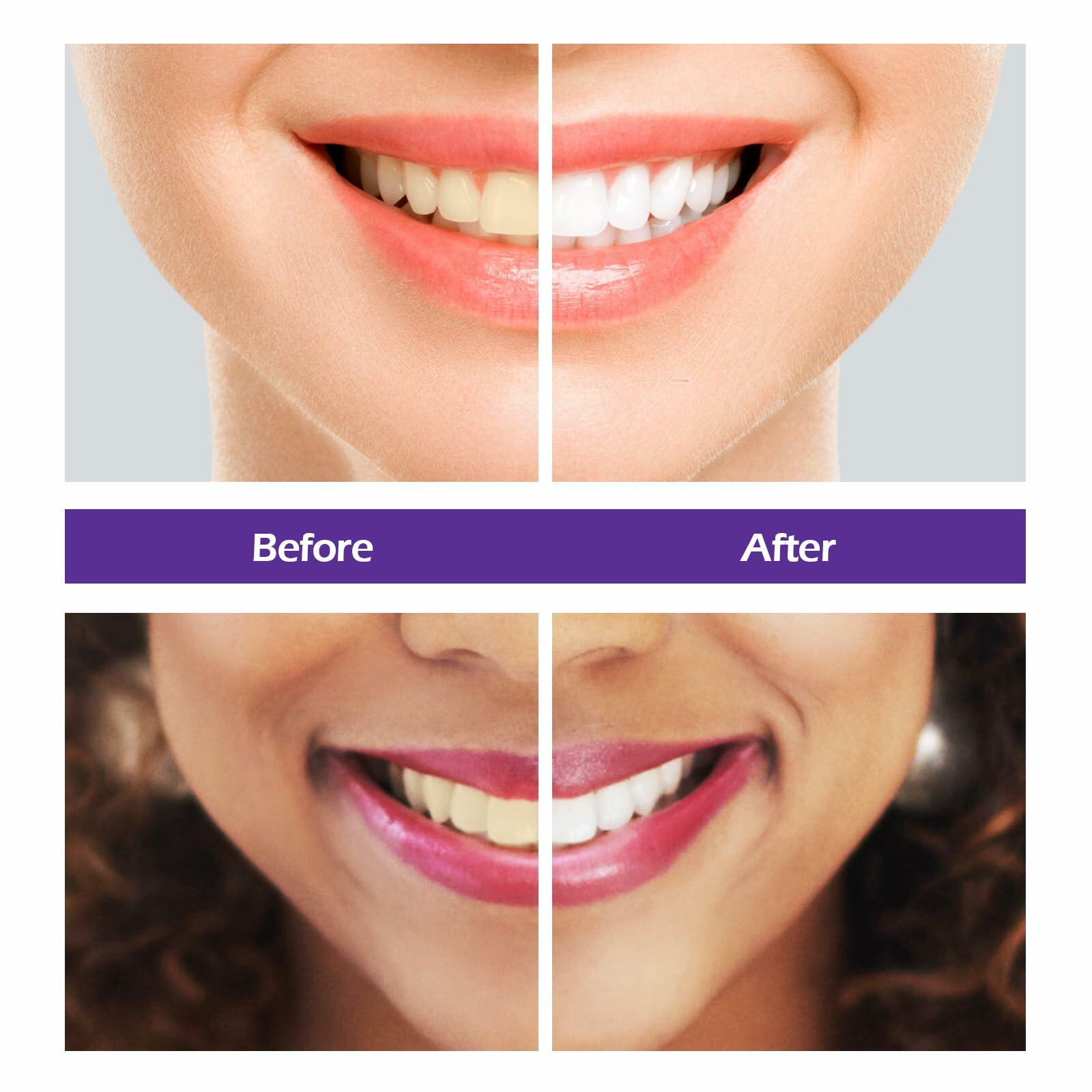 BestBy10/25 Rabbitooth Purple Teeth Whitening Serum 30ml Non-invasive Zero